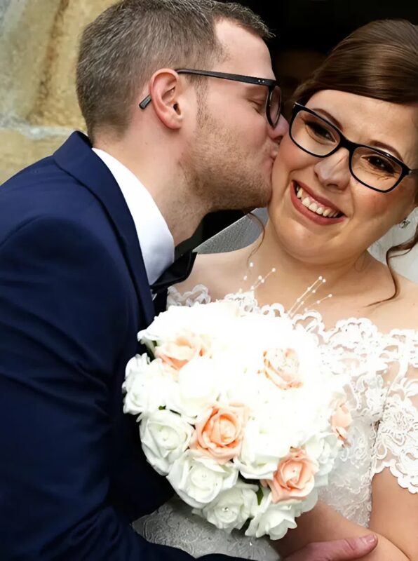 Egy súlyos arctorzulással született nő „boldog véget” ért – íme, mi történt vele.
