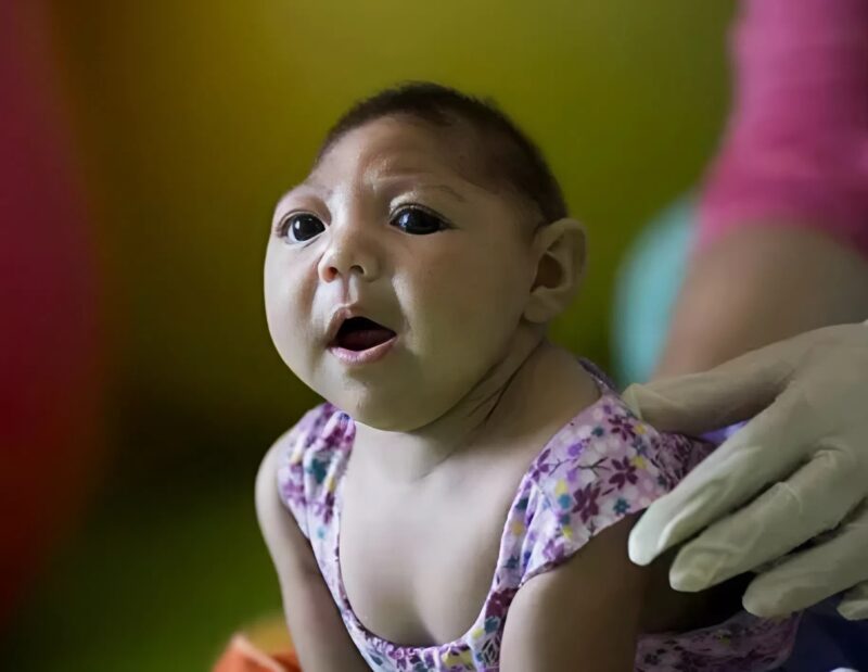 Senki sincs biztonságban a Zika-vírustól: megerősítés, hogy a szúnyogok által terjesztett vírus a meg nem született csecsemők fejét zsugorítja... és egy vészjósló figyelmeztetés.