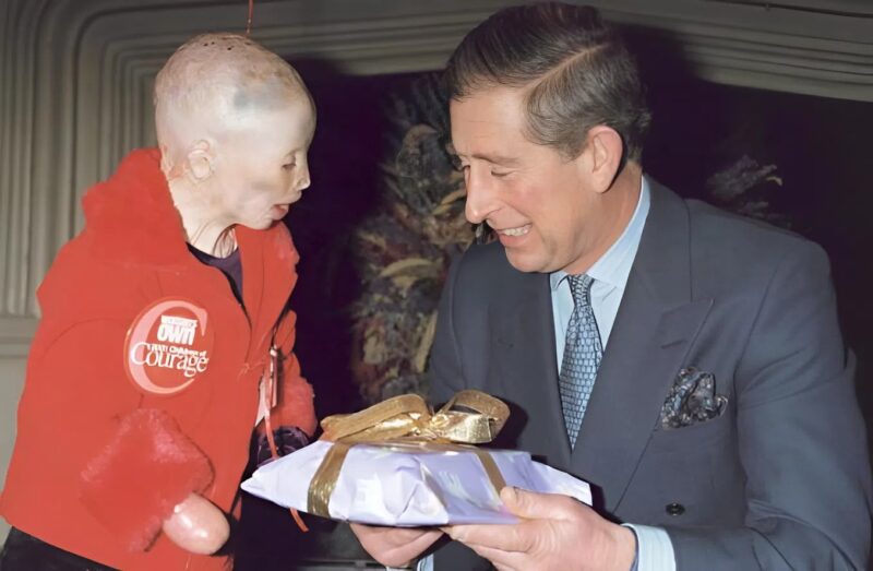 Egy 15 éves lány, akinek az arca megégett egy háztűzben, válaszokat szeretne kapni elidegenedett édesanyjától egy meggyújtott cigarettával kapcsolatban, amely a pusztító tüzet okozta.