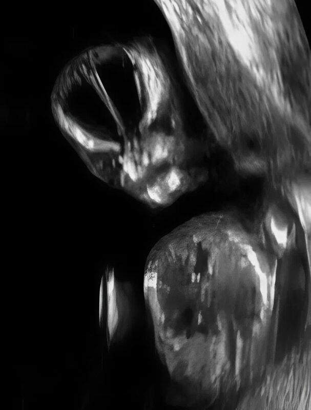 A nő megosztja a furcsa és érthetetlen ultrahangfotóit, és én még soha nem láttam ehhez hasonlót, mindenki fél és sokkos állapotban van.