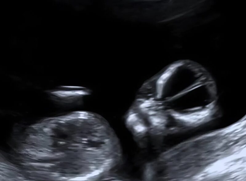 A nő megosztja a furcsa és érthetetlen ultrahangfotóit, és én még soha nem láttam ehhez hasonlót, mindenki fél és sokkos állapotban van.