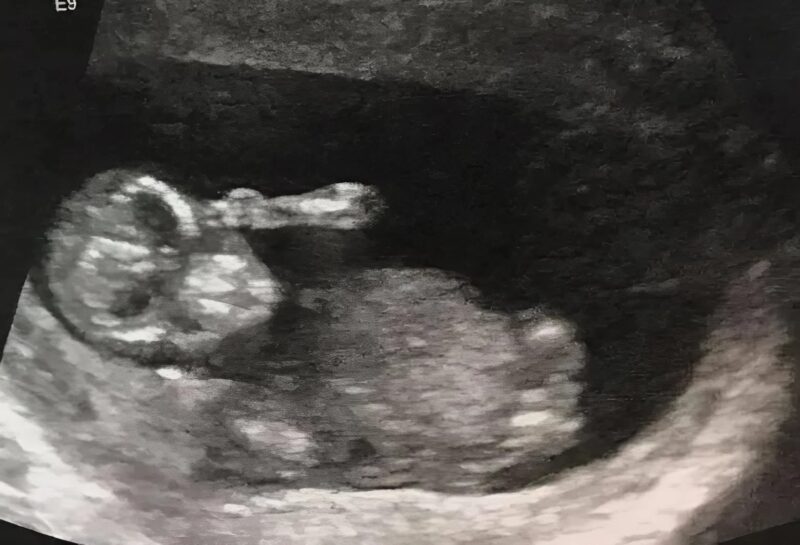 A nő megosztja a furcsa és érthetetlen ultrahangfotóit, és én még soha nem láttam ehhez hasonlót, mindenki fél és sokkos állapotban van.
