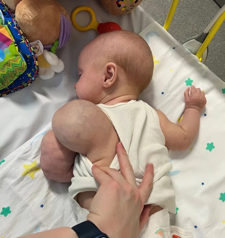 A kis Toby szülei felkészültek egy 13 órás műtétre, íme, hogyan zajlott le, és hogyan néz ki a műtét után.